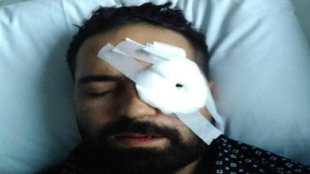 Ankara'da Yaşanan Darbe Girişimi ve Muhammed Musa Akkoç'un Cesur Mücadelesi
